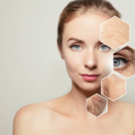 Achieve Younger-Looking Skin with Morpheus Treatment