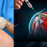 Discover 7 ways stem cell shoulder repair Bayonne enhances strength, restores mobility, and supports long-term shoulder health with minimally invasive care.