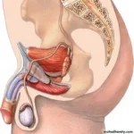 No Scalpel Vasectomy: Comparing Operative Tools and Equipment