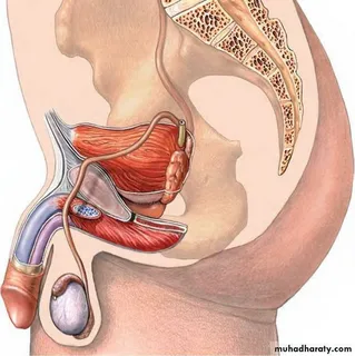 No Scalpel Vasectomy: Comparing Operative Tools and Equipment
