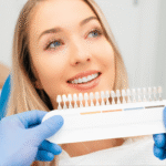 Veneers in Dubai Explained: Procedure, Materials, and Results