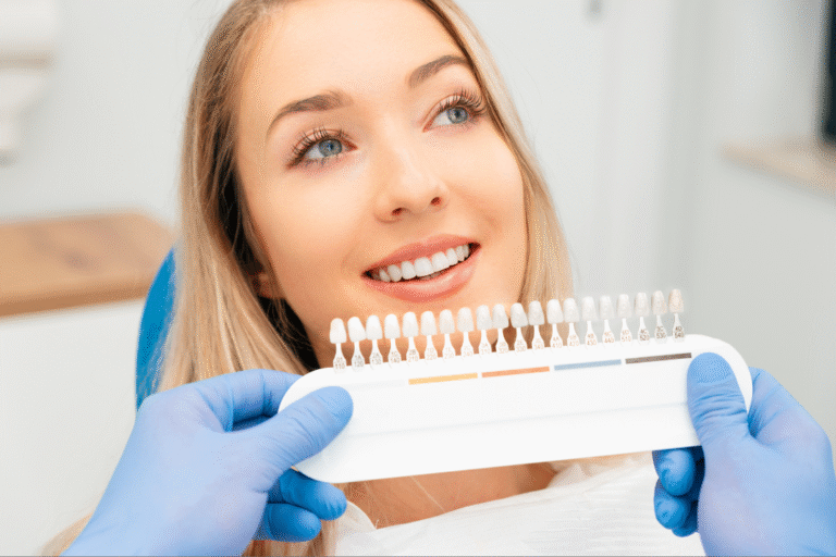 Veneers in Dubai Explained: Procedure, Materials, and Results