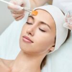Chemical Peels Islamabad