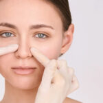 Rhinoplasty in Dubai