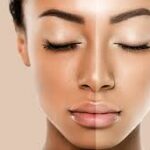 Skin Whitening in Islamabad