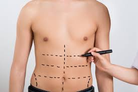 Tummy Tuck in Islamabad