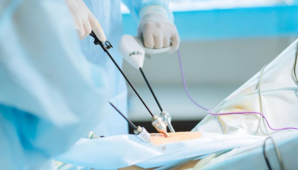 best laparoscopic surgery in Islamabad