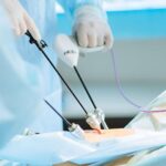 best laparoscopic surgery in Islamabad