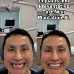 Preventive Dental Care Near Plantation, FL – Protect Your Smile for Life