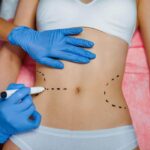 Bariatric Surgery in Islamabad