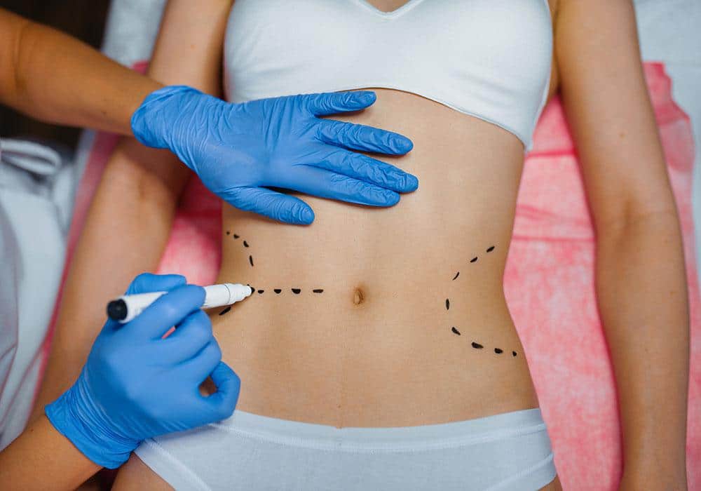 Bariatric Surgery in Islamabad