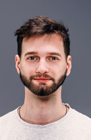 Beard Hair Transplant in Islamabad