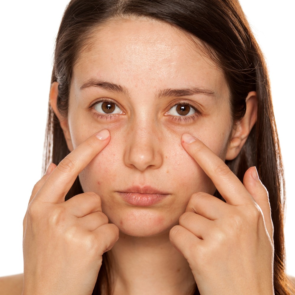 dark circles treatment