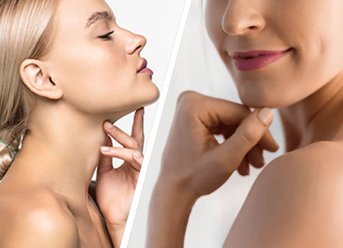 Double Chin Liposuction in Islamabad 1