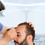 زراعة الشعر في دبي