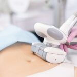 Curves That Inspire: Body Contouring in Islamabad