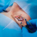 PRK Eye Surgery in Gurgaon: How to Choose the Right Ophthalmologist