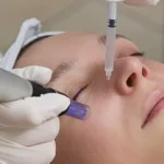 How Salmon Dna In Dubai Revitalizes Dull and Aging Skin