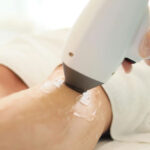 إزالة الشعر بالليزر في دبي