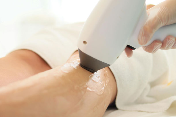 إزالة الشعر بالليزر في دبي