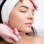 Thread Lift Treatment in Riyadh: Safe and Effective Skin Rejuvenation
